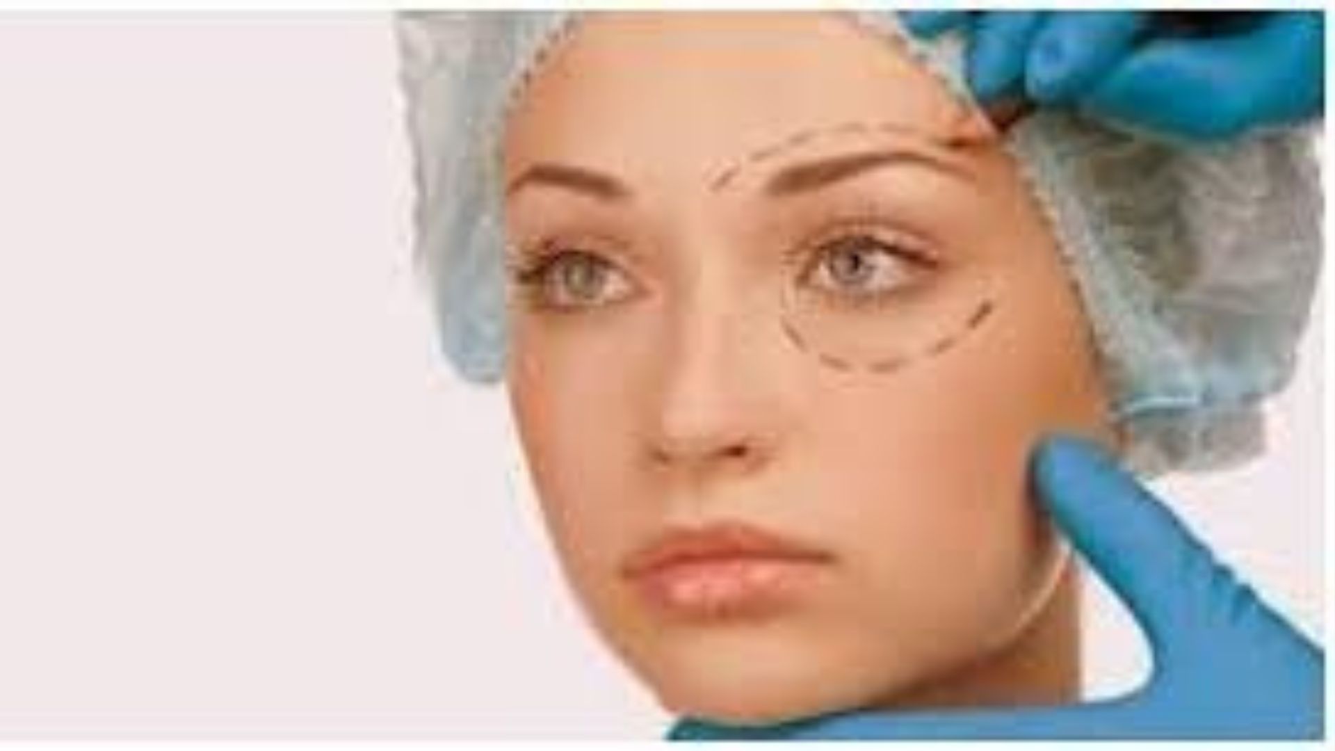 Advanced Eye Clinic Services: What You Need to Know About Oculoplasty - Malhar Eye Care Services Pune