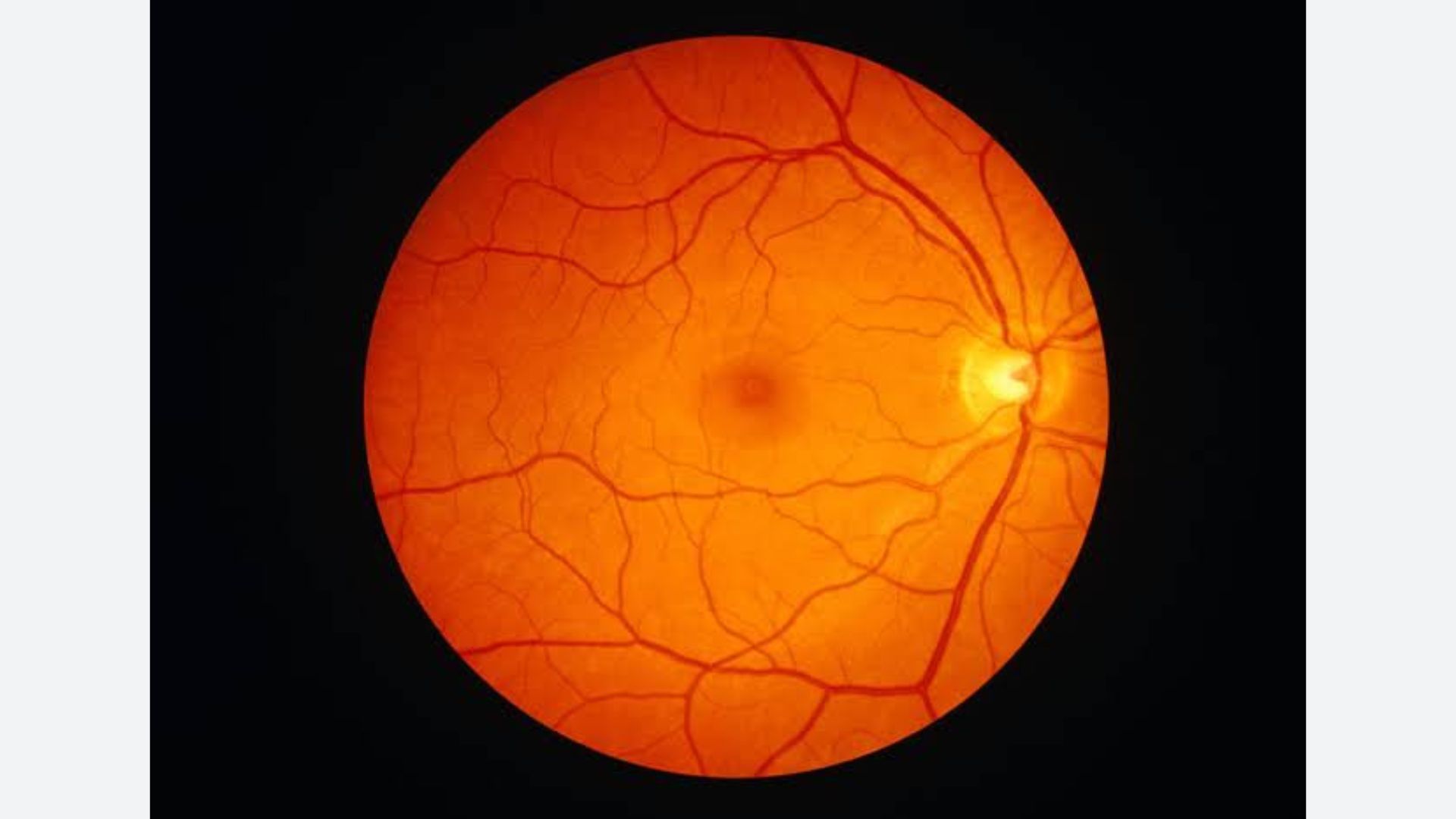 Retina Clinic