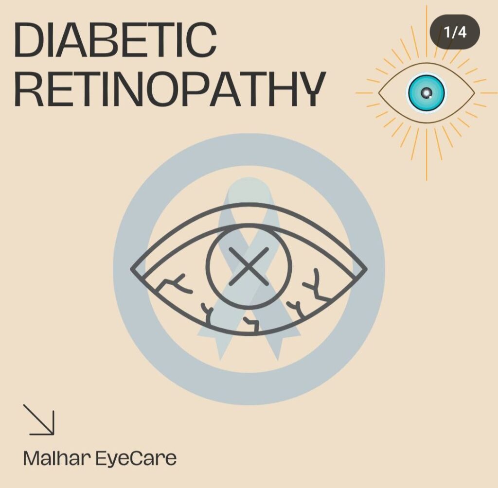 Diabetic Retinopathy Treatment: A Comprehensive Guide