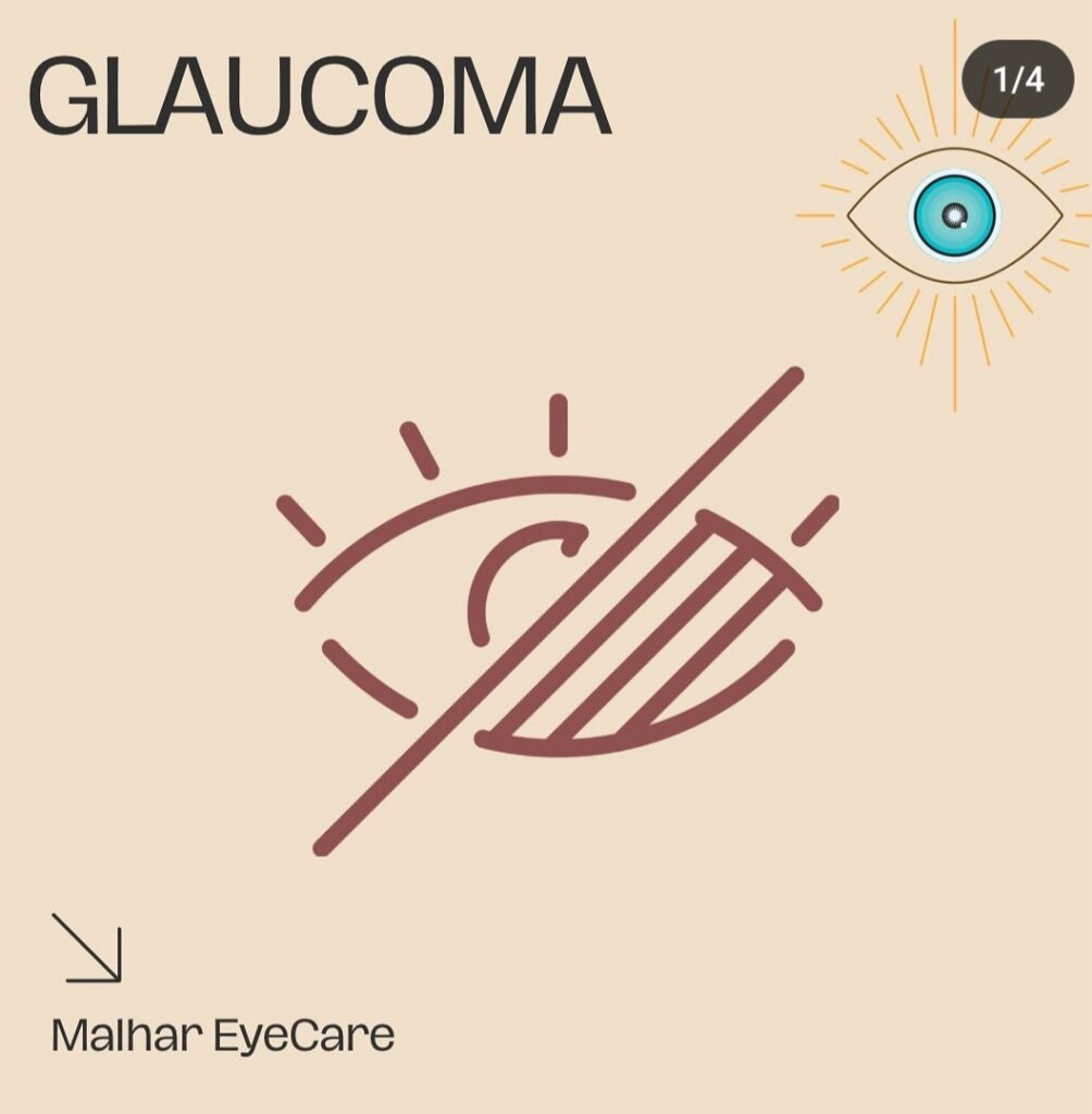 Glaucoma Treatment Options: Protecting Your Vision